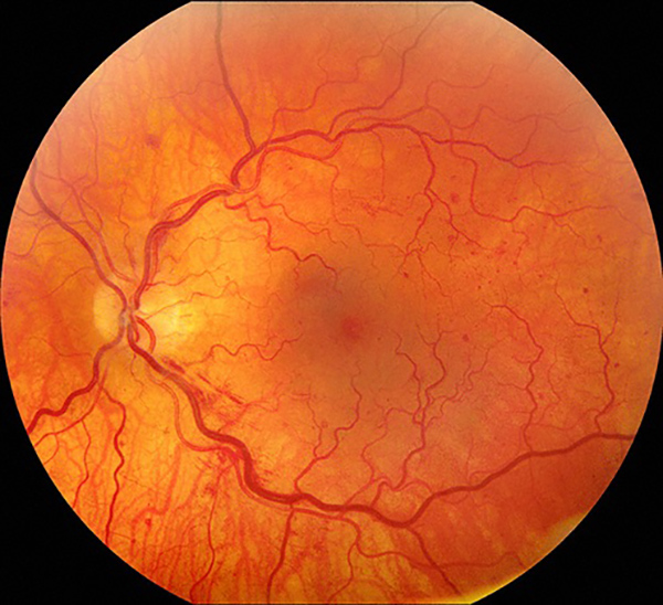 Retinal imaging equipment at Dr Buie Optometry Fort Worth